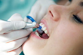 Close Up von einer Zahnpolitur Behandlungssituation in einer Zahnarztpraxis aus Köln. Gute Fotos für Kölner Zahnärzte.